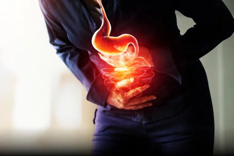 Heartburn During Ramadan: Why It Happens and How to Avoid It